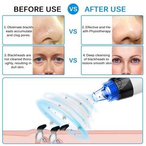 Pore cleaners machine